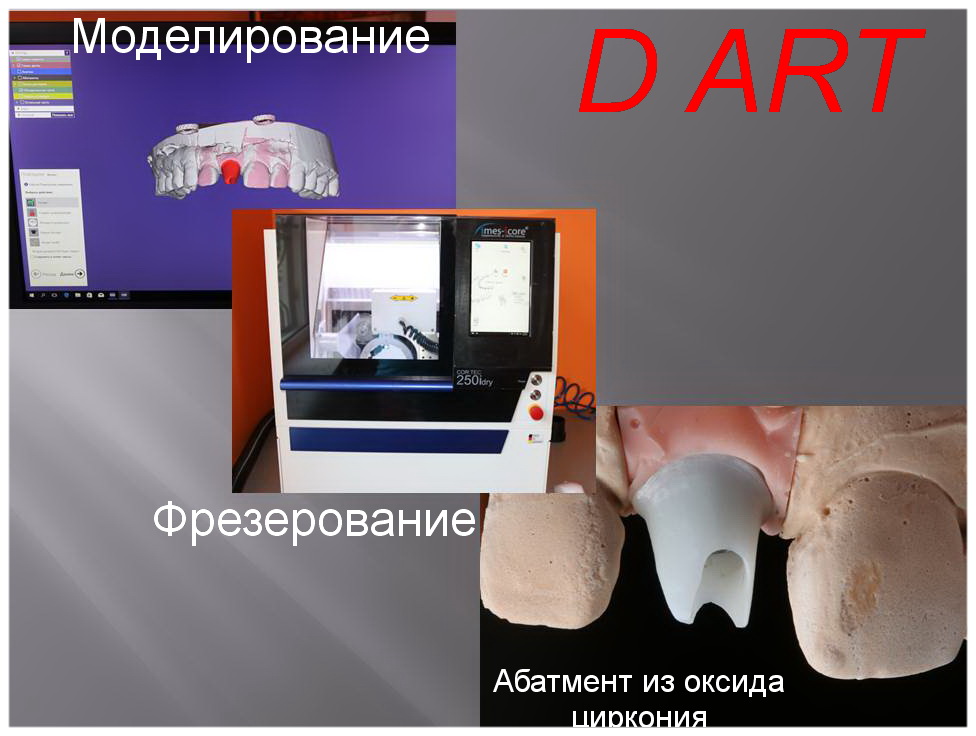 стоматологические клиники фрезерный центр