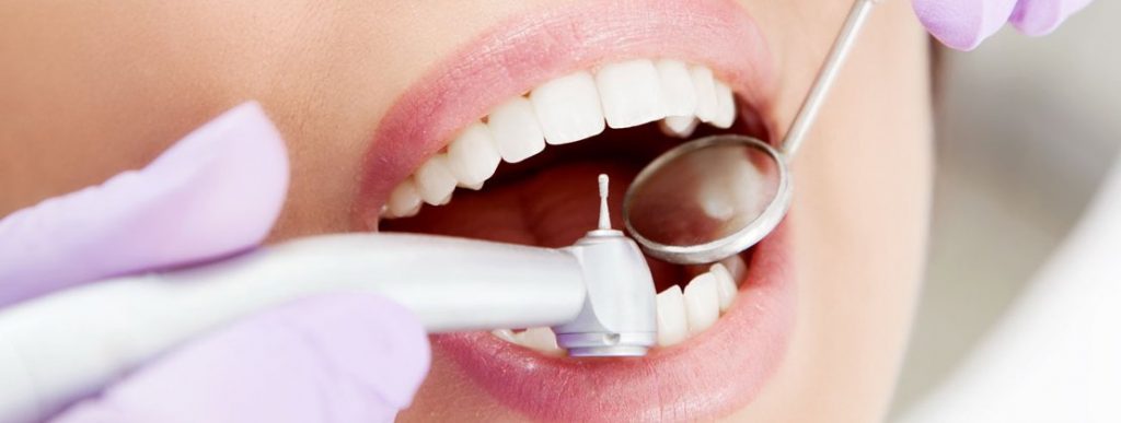 лечение зубов профессионально