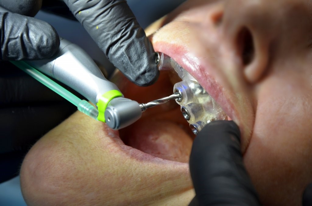 3д снимок зубов услуги