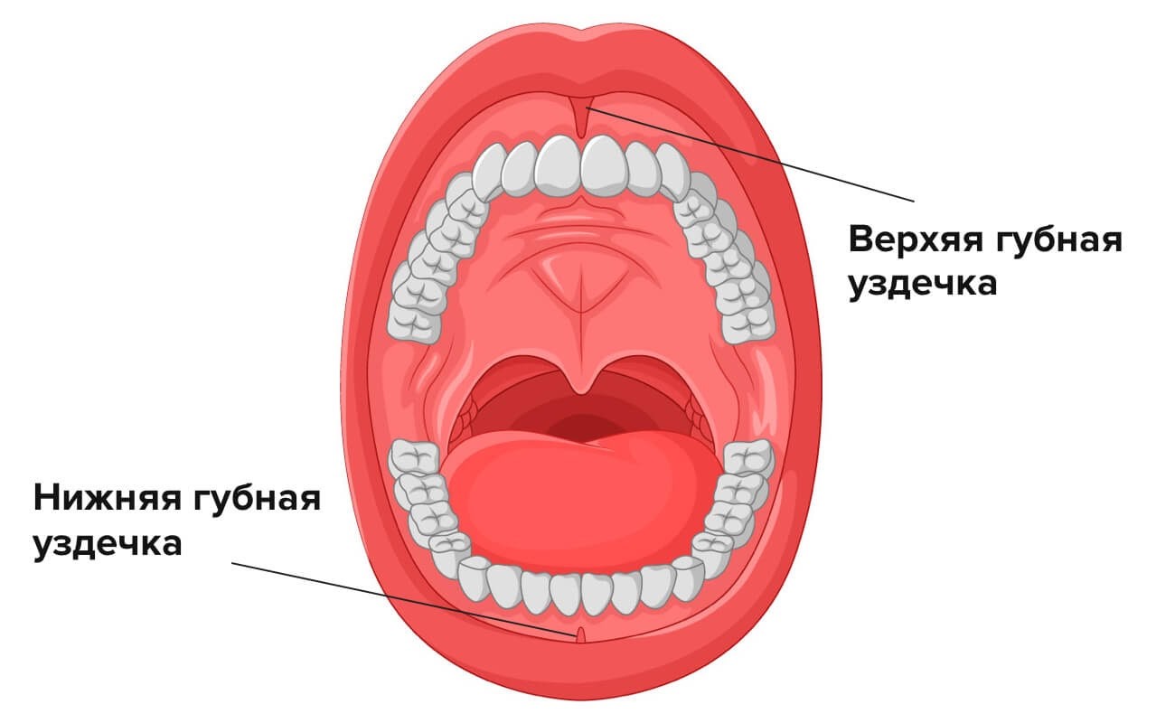 Фото нормальной уздечки верхней губы